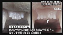 «داروی رشد مجدد دندان» تولید شد