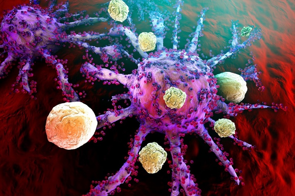 سلول سرطانی
