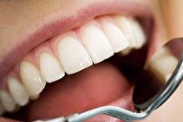 US Journal Introduces Dentistry Method Developed by Iranian Doctor as a Global Protocol