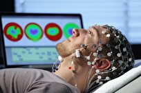 iranian-company-produces-special-gel-for-electroencephalogram-test