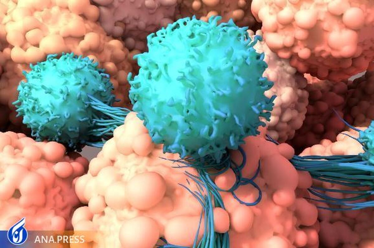 روشی جدید برای از بین بردن «سرطان پانکراس» با حداقل عوارض جانبی