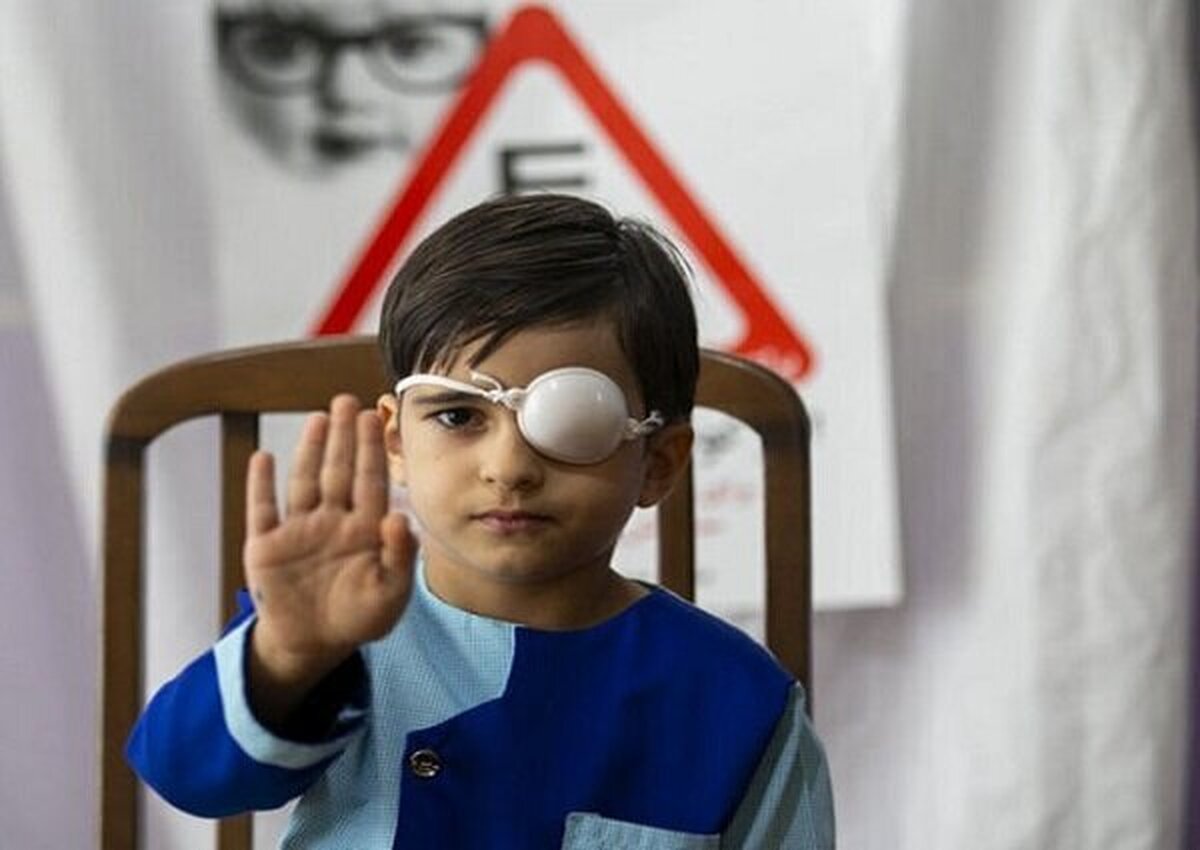 طرح رایگان غربالگری تنبلی چشم کودکان در سراسر کشور آغاز شد