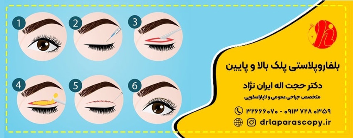 از نظر رتبه بندی بهترین جراح زیبایی چشم در اصفهان کیست؟