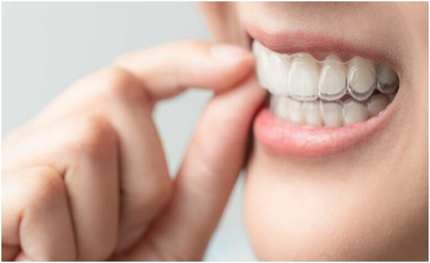 چرا ارتودنسی نامرئی سریع ترین روش مرتب کردن دندان هاست؟