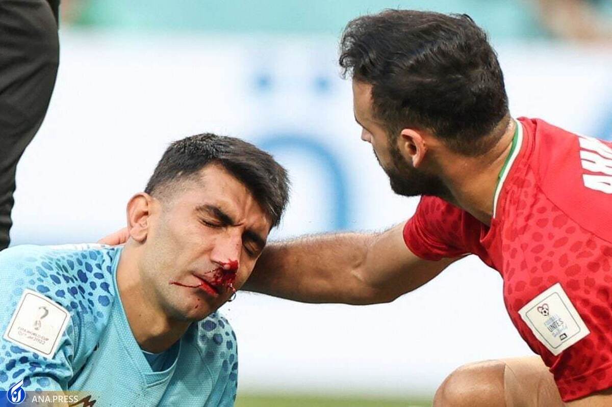 بیرانوند به بیمارستان منتقل شد  آخرین وضعیت دروازه‌بان تیم ملی
