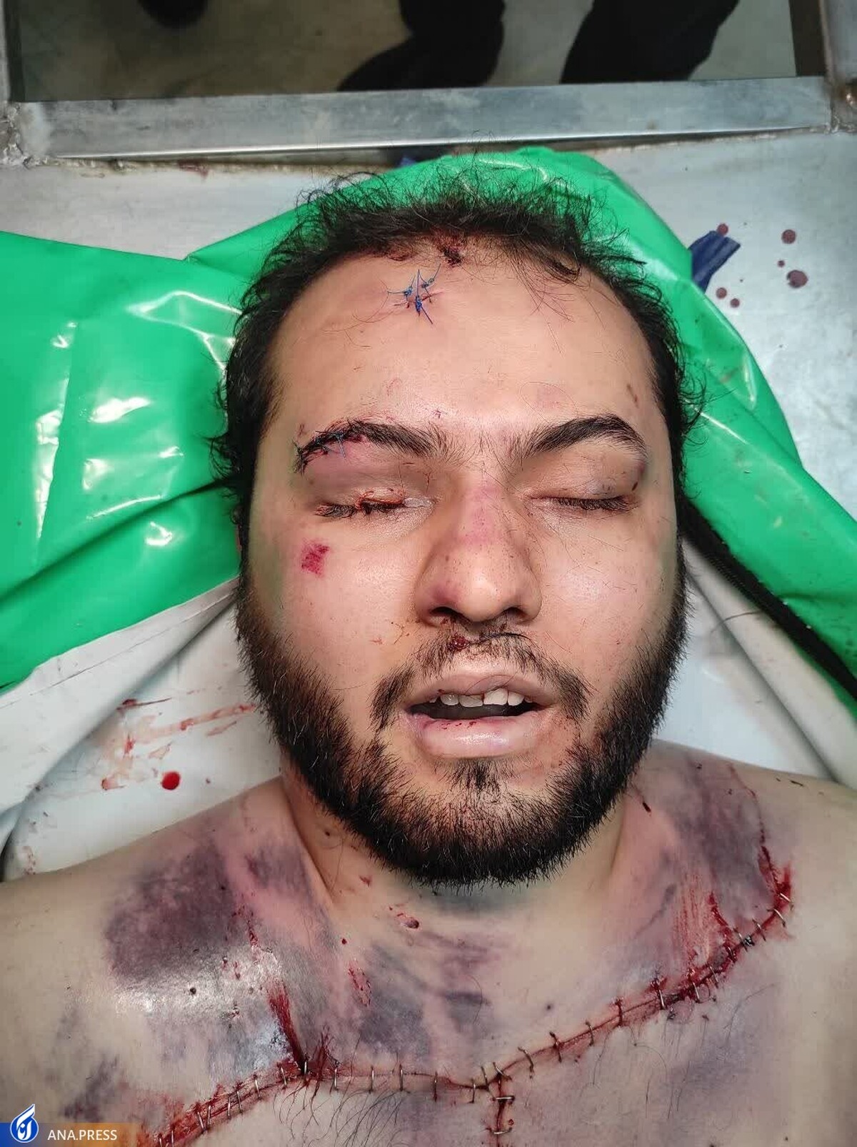 عامل تکفیری حادثه تروریستی شیراز به هلاکت رسید