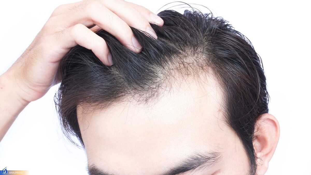 ۴ درمان خانگی برای ترمیم مو‌های آسیب دیده از گرما