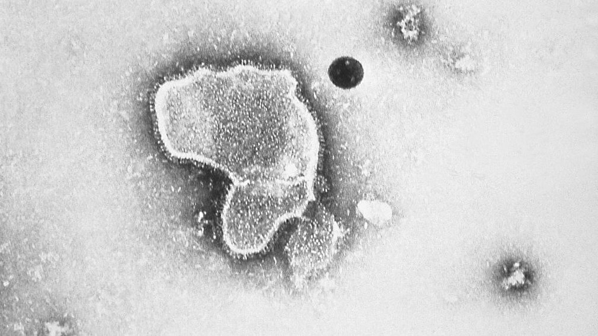 نخستین واکسن بیماری RSV تایید شد