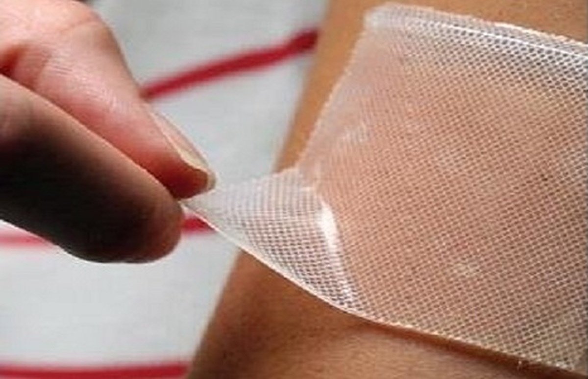 تولید پانسمان‌های پلیمری برای درمان زخم‌های دیابتی