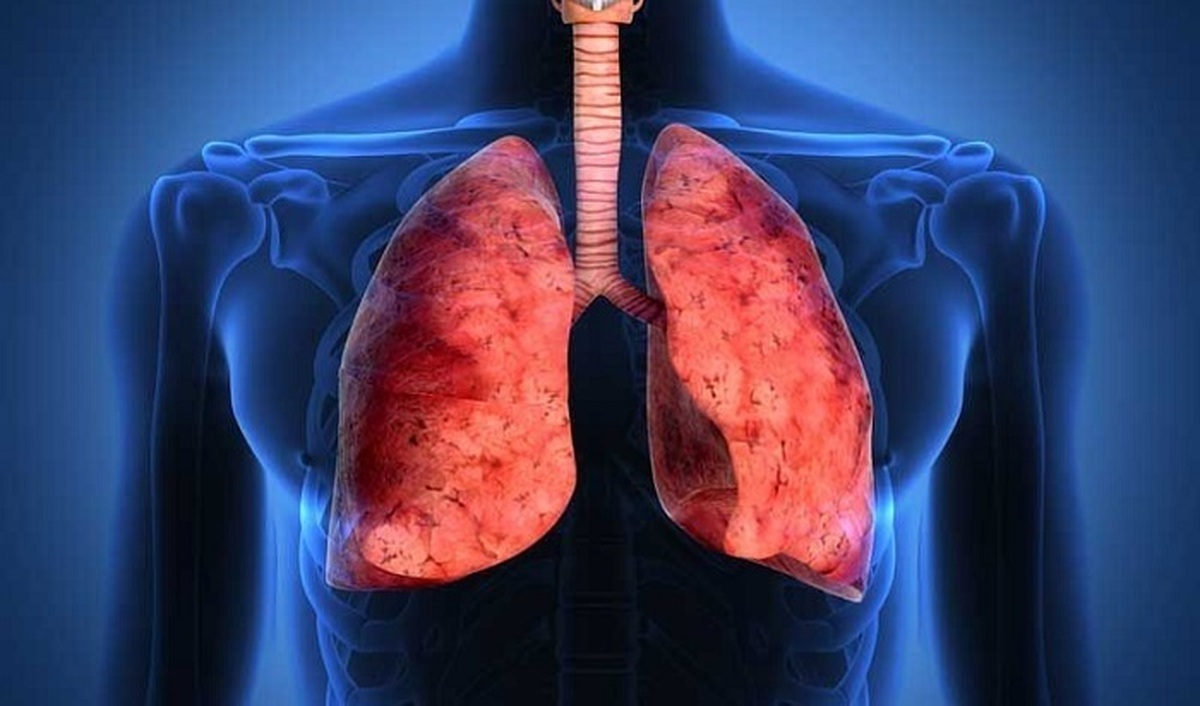 درمان فیبروز ریه با استفاده از «سلول‌های بنیادی» برای نخستین بار در کشور