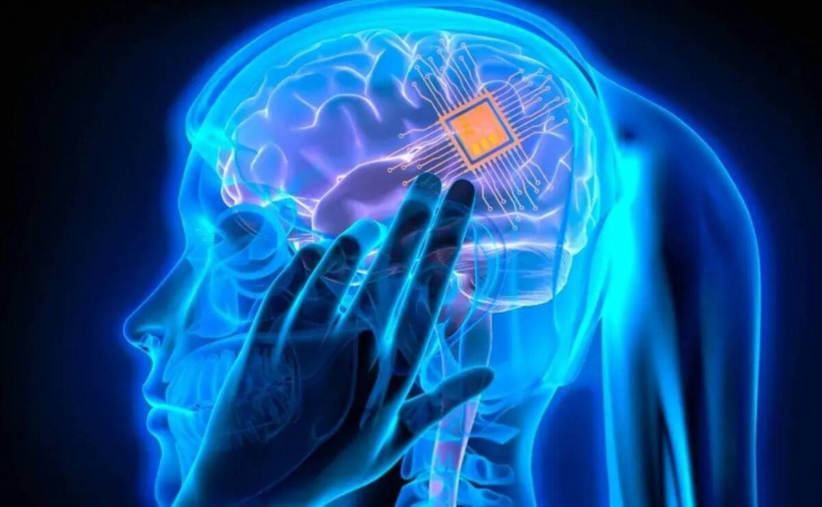 ایمپلنت‌های مغزی پهن‌‌باند ارتباط مغز و رایانه را بهبود می‌دهند