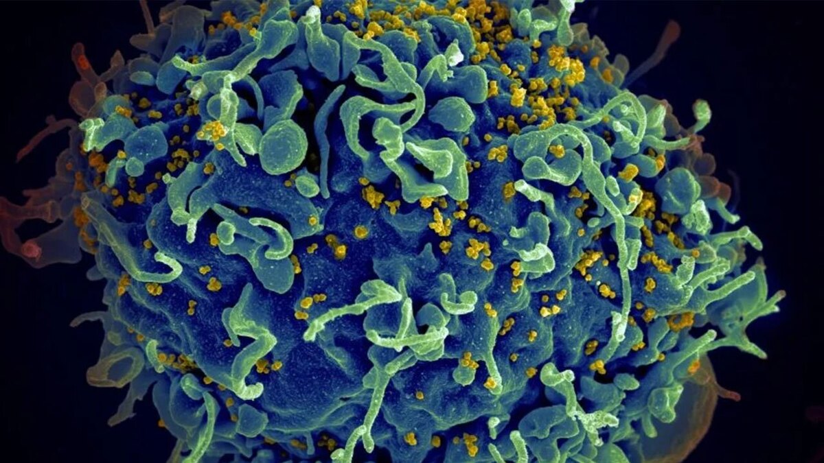 فناوری نانو برای شکار ویروس ایدز به‌کار گرفته شد