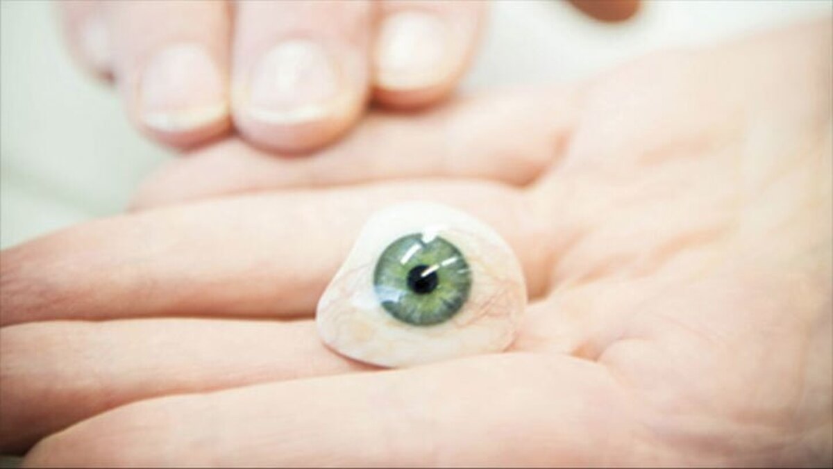 ساخت پروتزهای زیبایی چشم مصنوعی، بینی، گوش و انگشتان دست